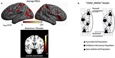 Ketamine and Attentional Bias Toward Emotional Faces: Dynamic Causal Modeling of Magnetoencephalographic Connectivity in Treatment-Resistant Depression
